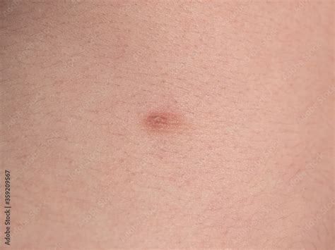 Brand new <strong>nipple</strong> piercings in less than one minute. . Nipple closeup